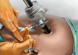 Laproscopic surgeon in rohini
